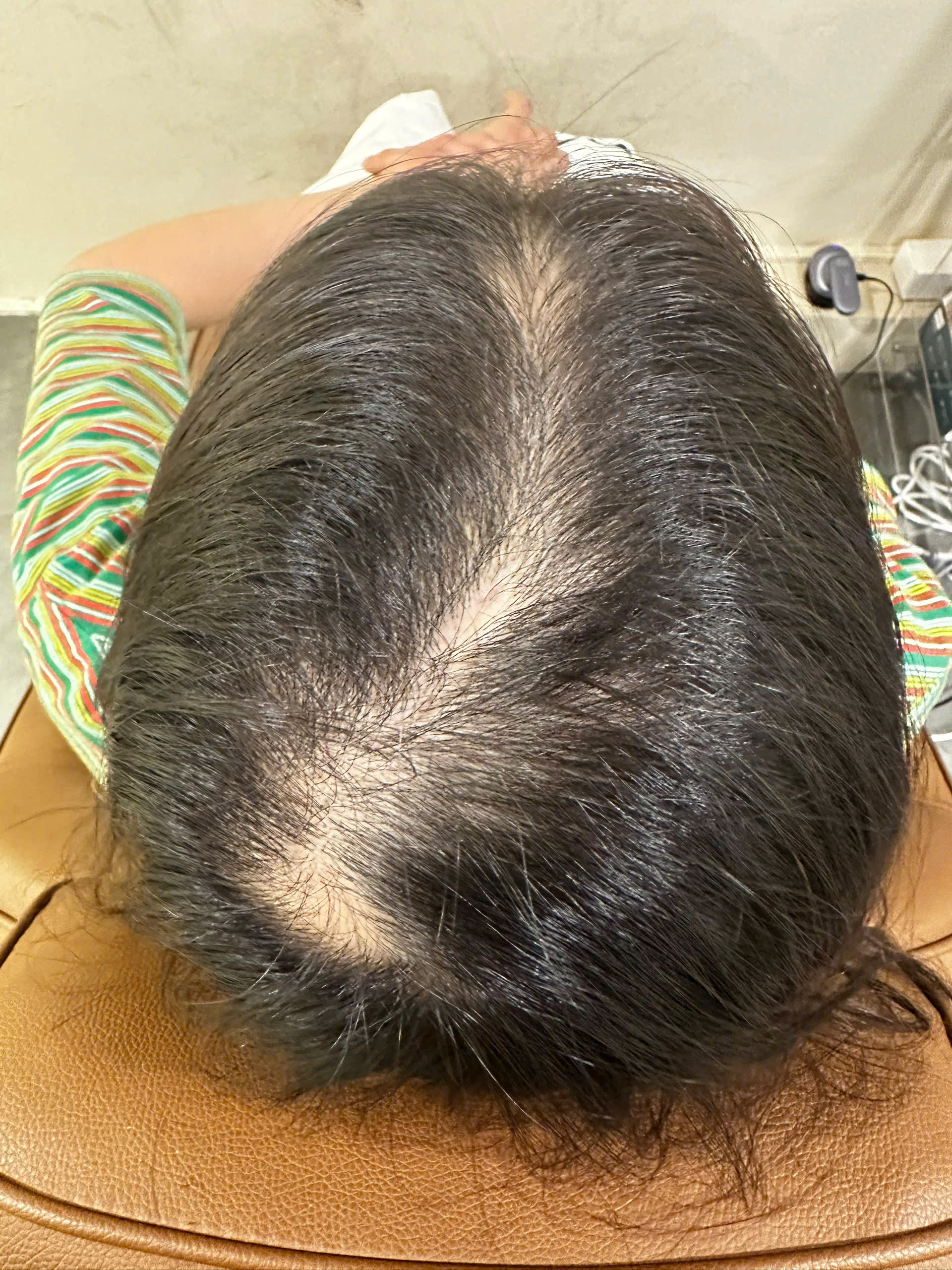 Ảnh trước - Ca 07