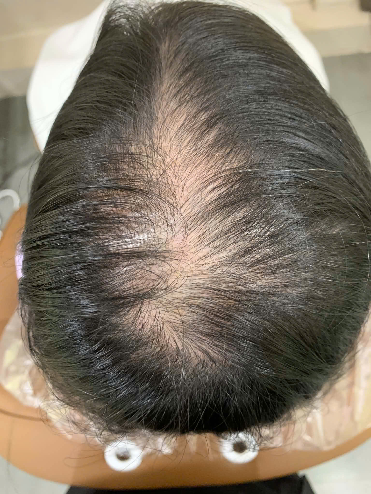 Ảnh trước - Ca 01