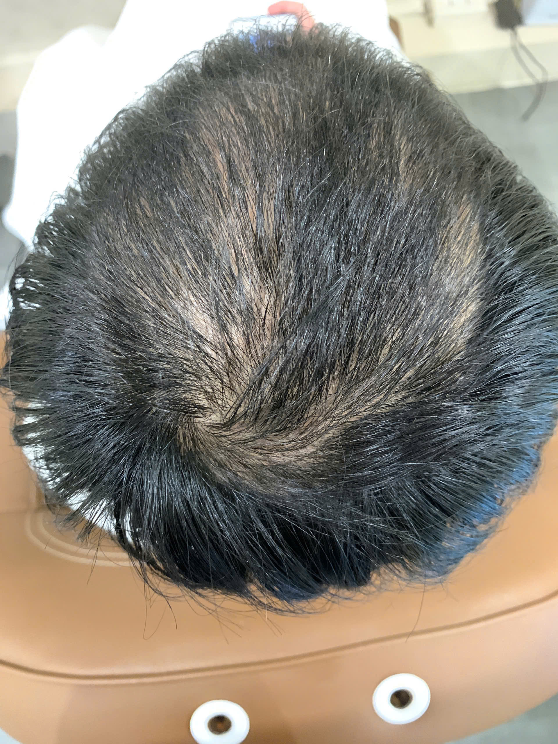 Ảnh trước - Ca 03