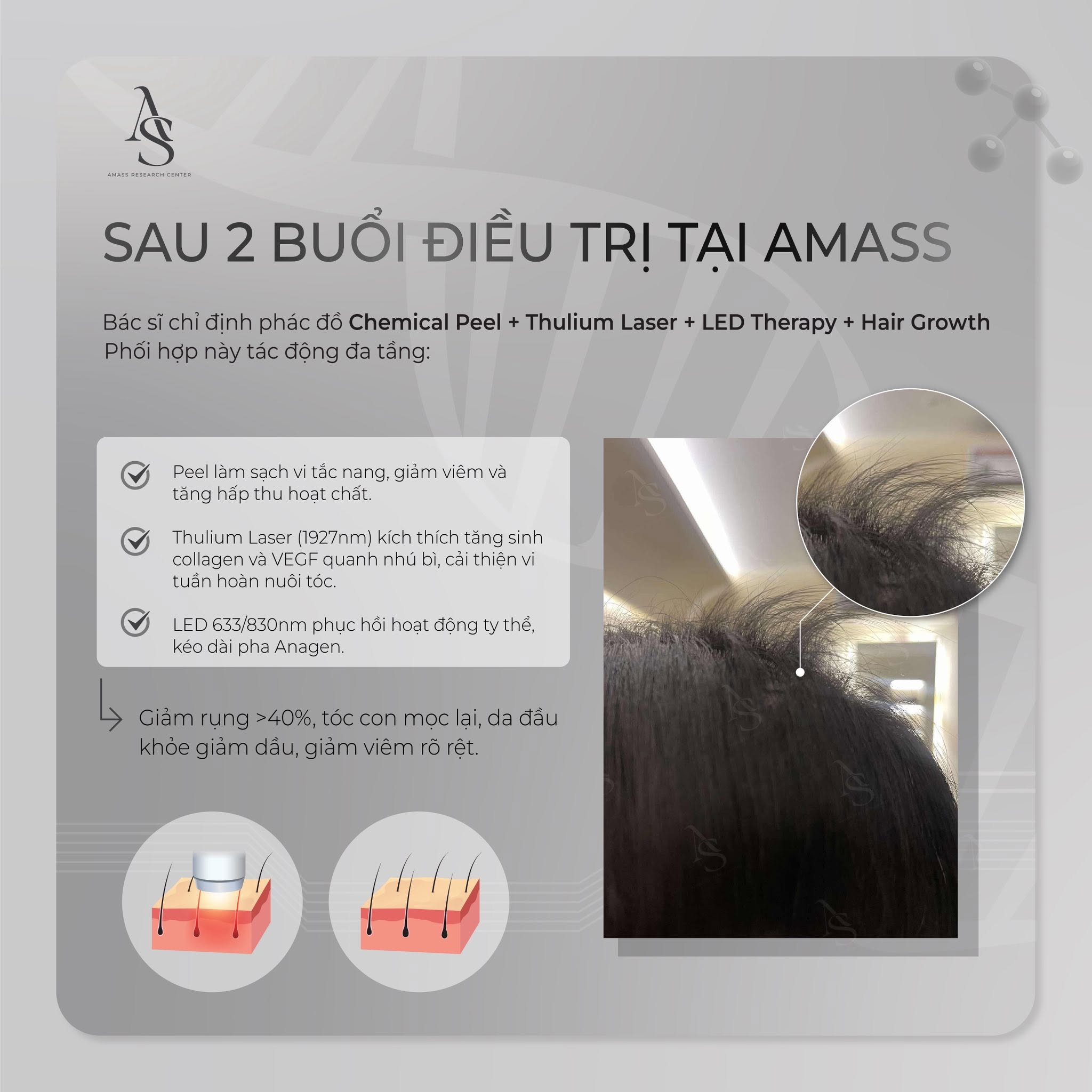 điều trị rụng tóc Amass