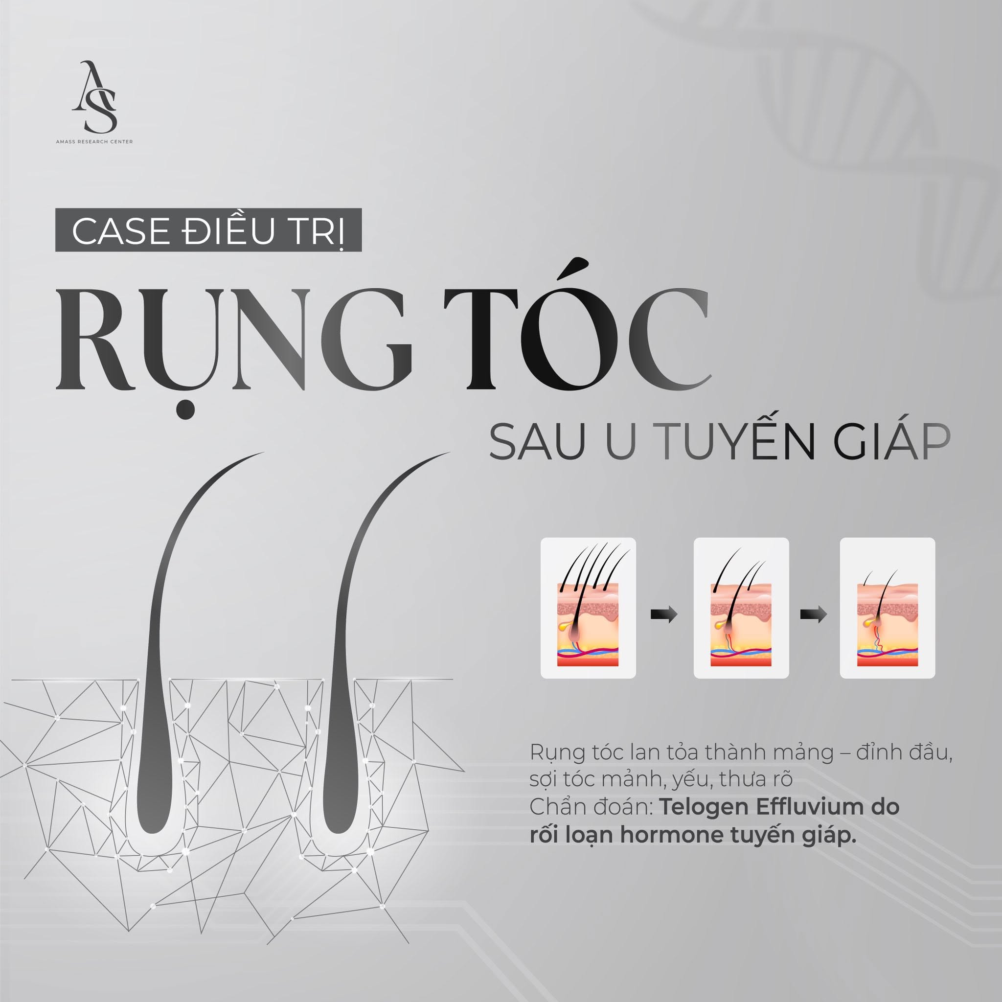 điều trị rụng tóc
