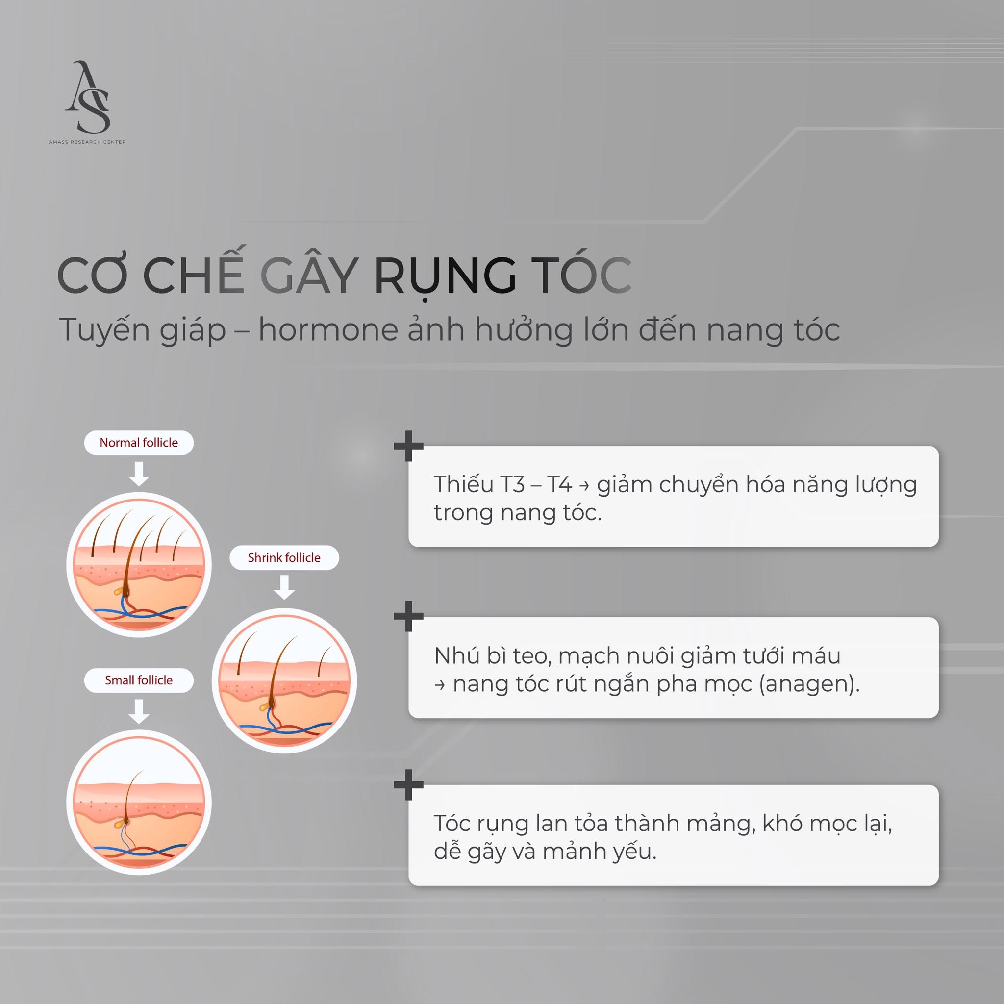 điều trị rụng tóc tại amass