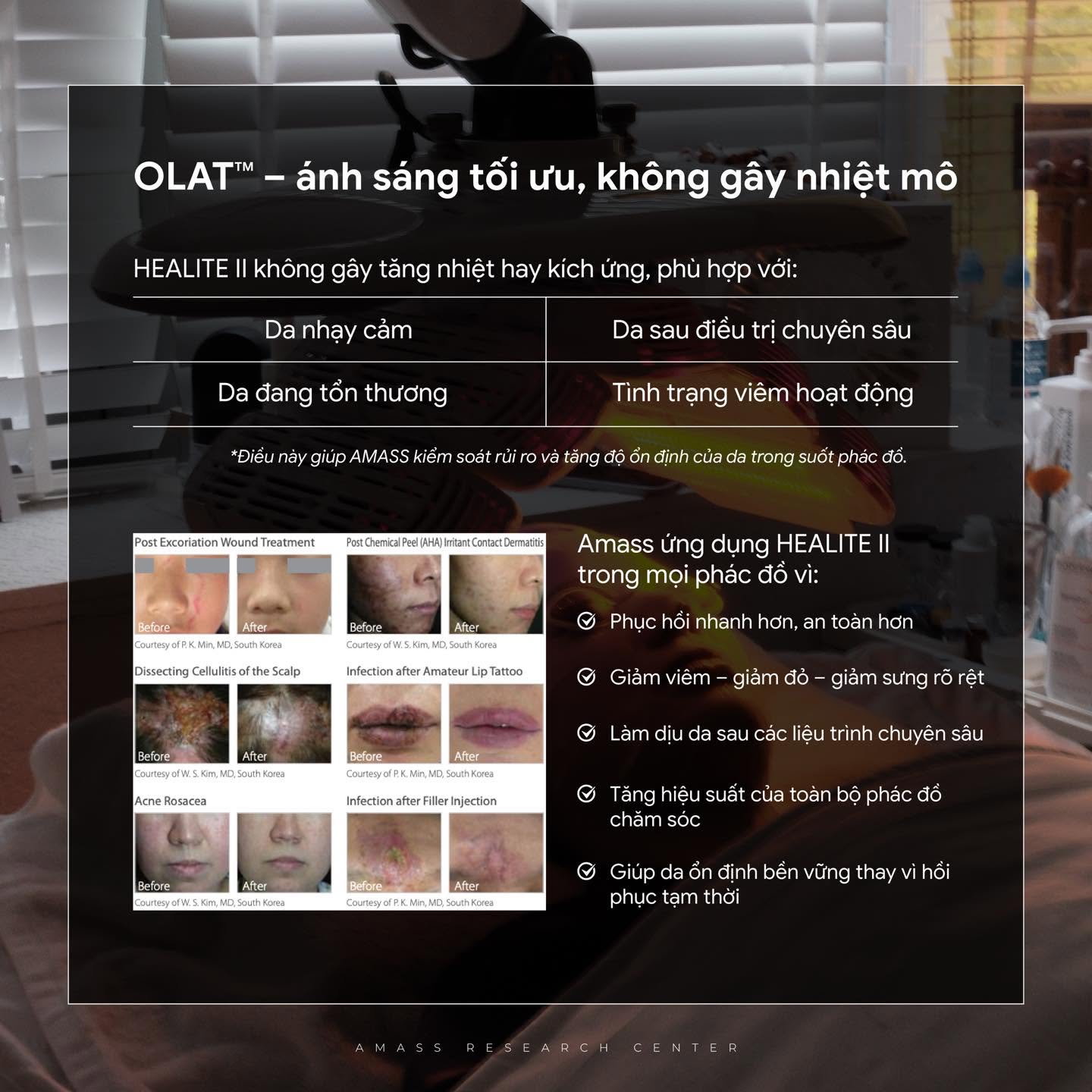 HEALITE II đạt tiêu chuẩn FDA với nhiều ứng dụng trong phục hồi tổn thương, giảm viêm, hỗ trợ điều trị mụn và trẻ hóa làn da.