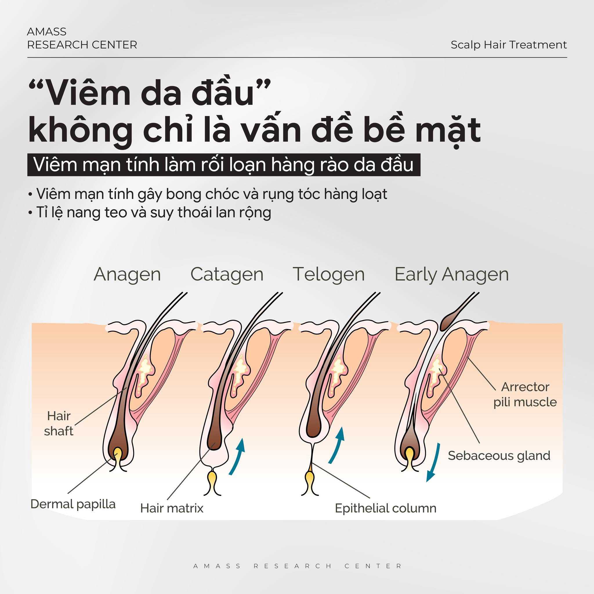 Amass điều trị rụng tóc