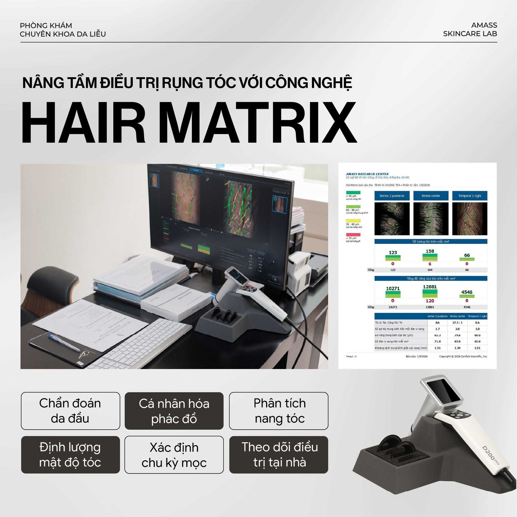 Hair Matrix – Công nghệ phân tích nang tóc hàng đầu
