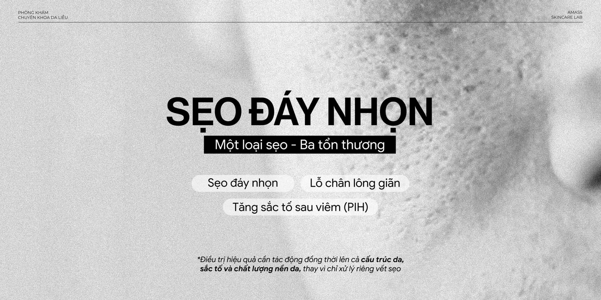 Sơ đồ sẹo