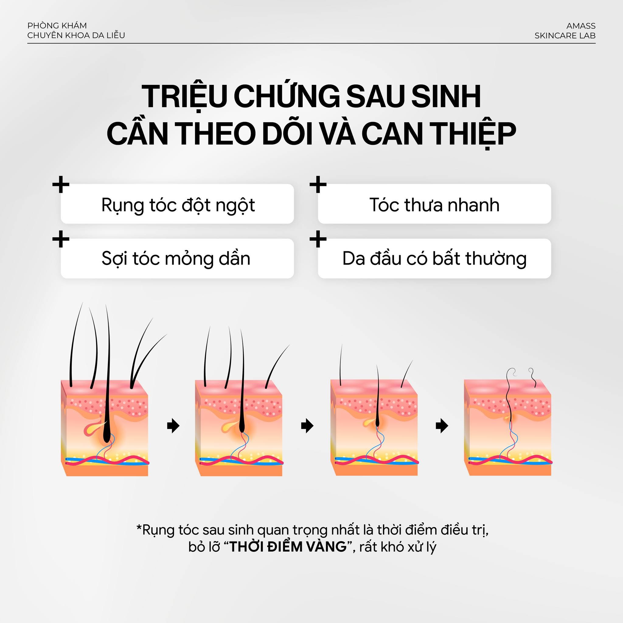 Cac trieu chung can theo doi va dieu tri rung toc sau sinh kip thoi