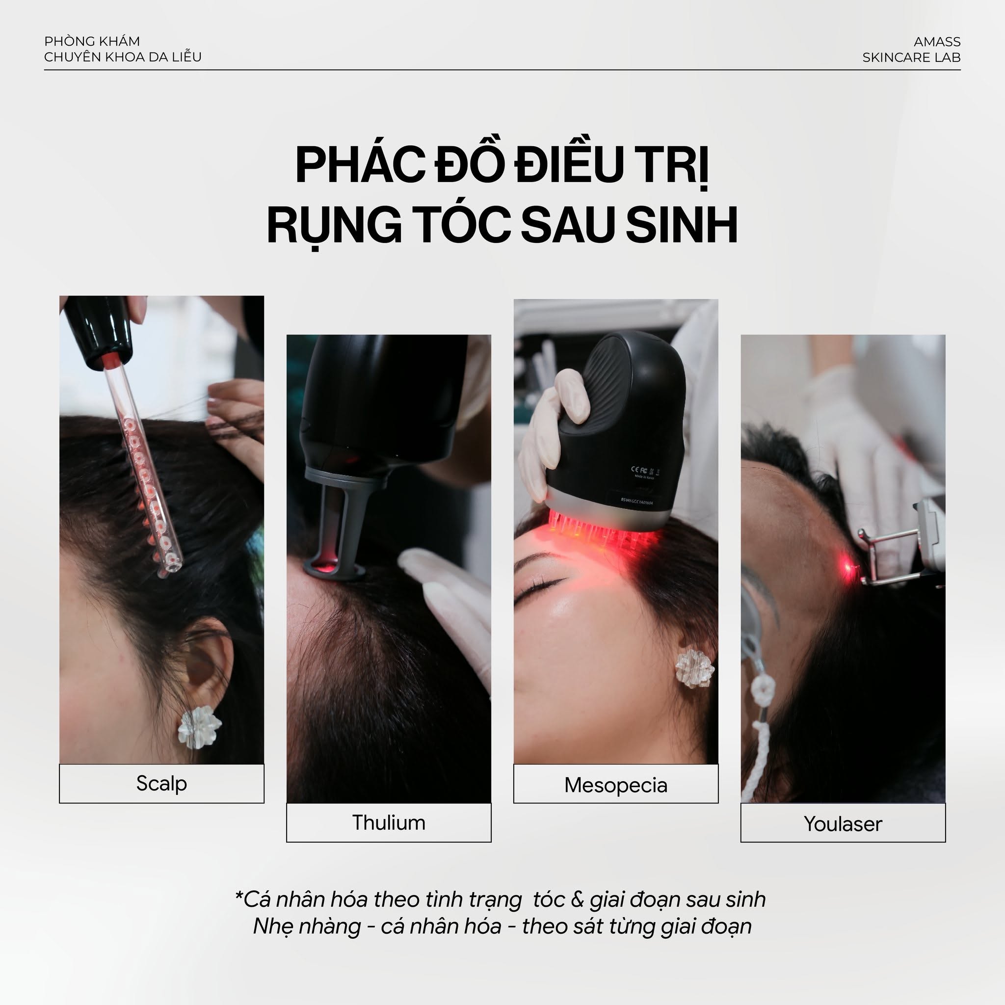 Điều Trị Rụng Tóc Sau Sinh Chuẩn Y Khoa Hiệu Quả Nhất