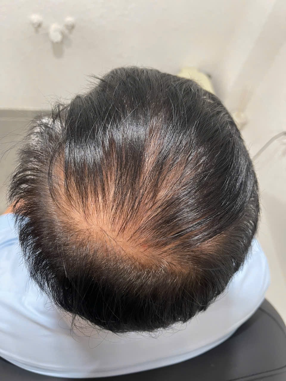Ảnh sau - Ca 06