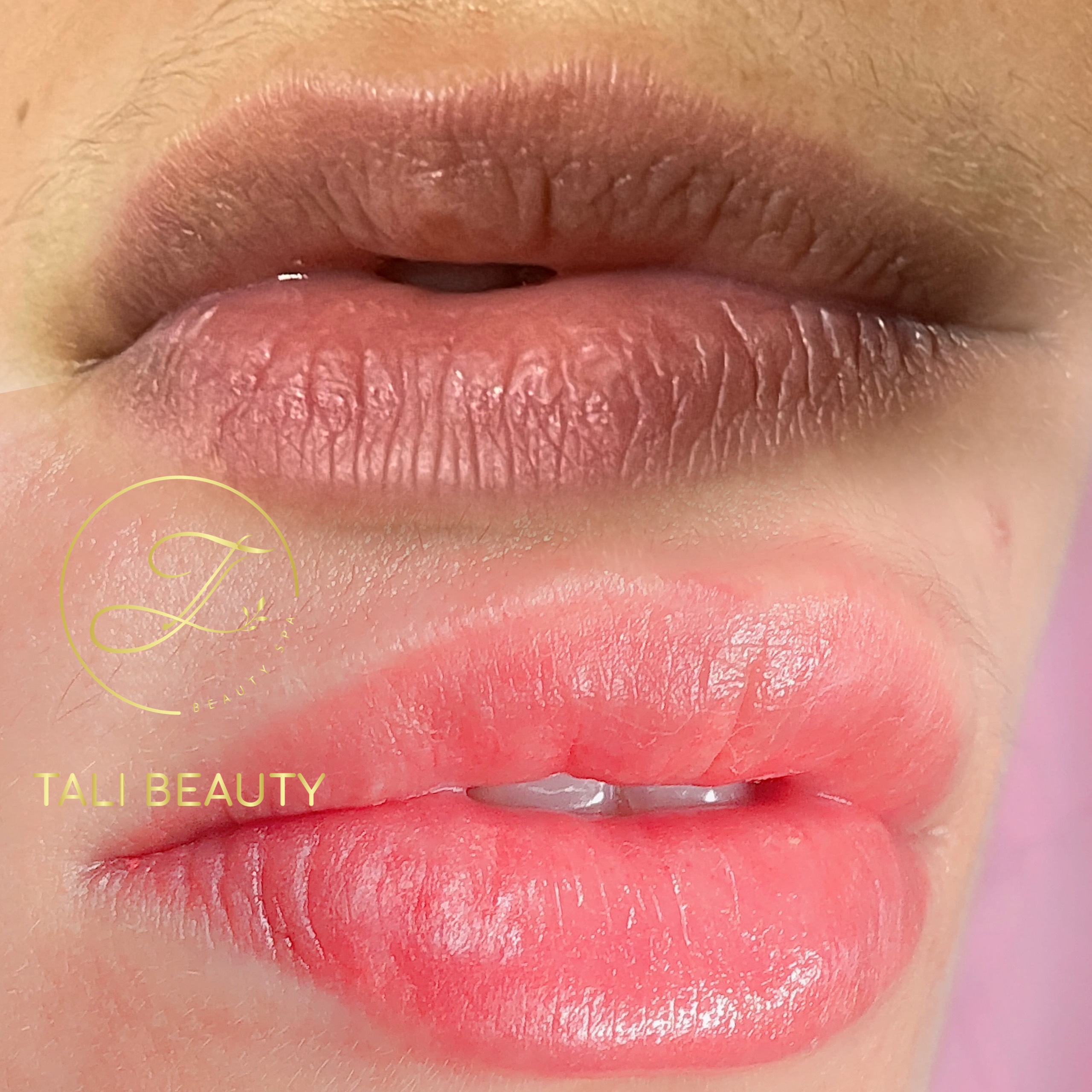 Phun Môi Candy Lip L-Lips Tali Beauty – Làn Môi Tươi Tắn, Tự Nhiên Quyến Rũ